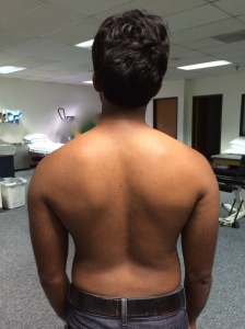 Downward Rotation of the Scapula is one where the inferior angle is more medial than the superior angle of the scapula.